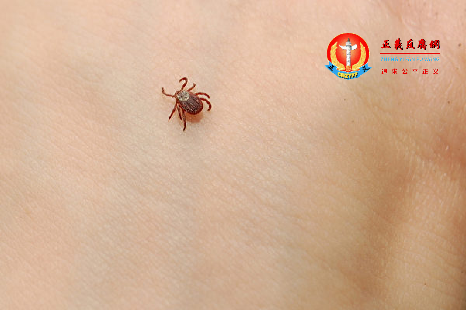 蜱虫示意图。.png 蜱虫示意图。.png